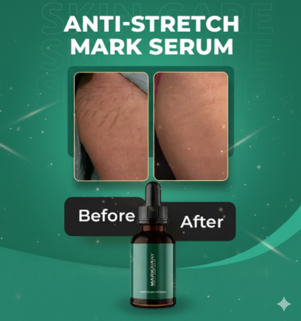 Markaway Stretch Mark Serum – 30ml